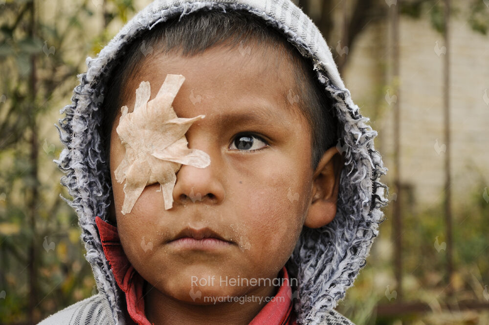 Junge mit einem Auge